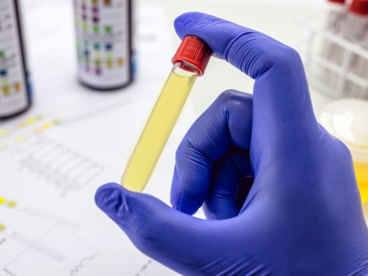 mano con provetta in laboratorio