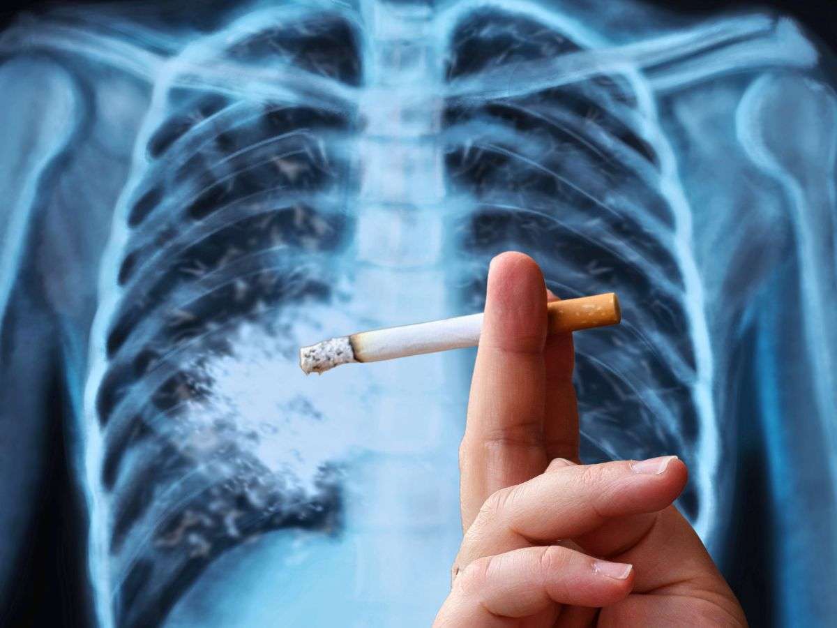 sfondo lastra polmoni e mano con sigaretta